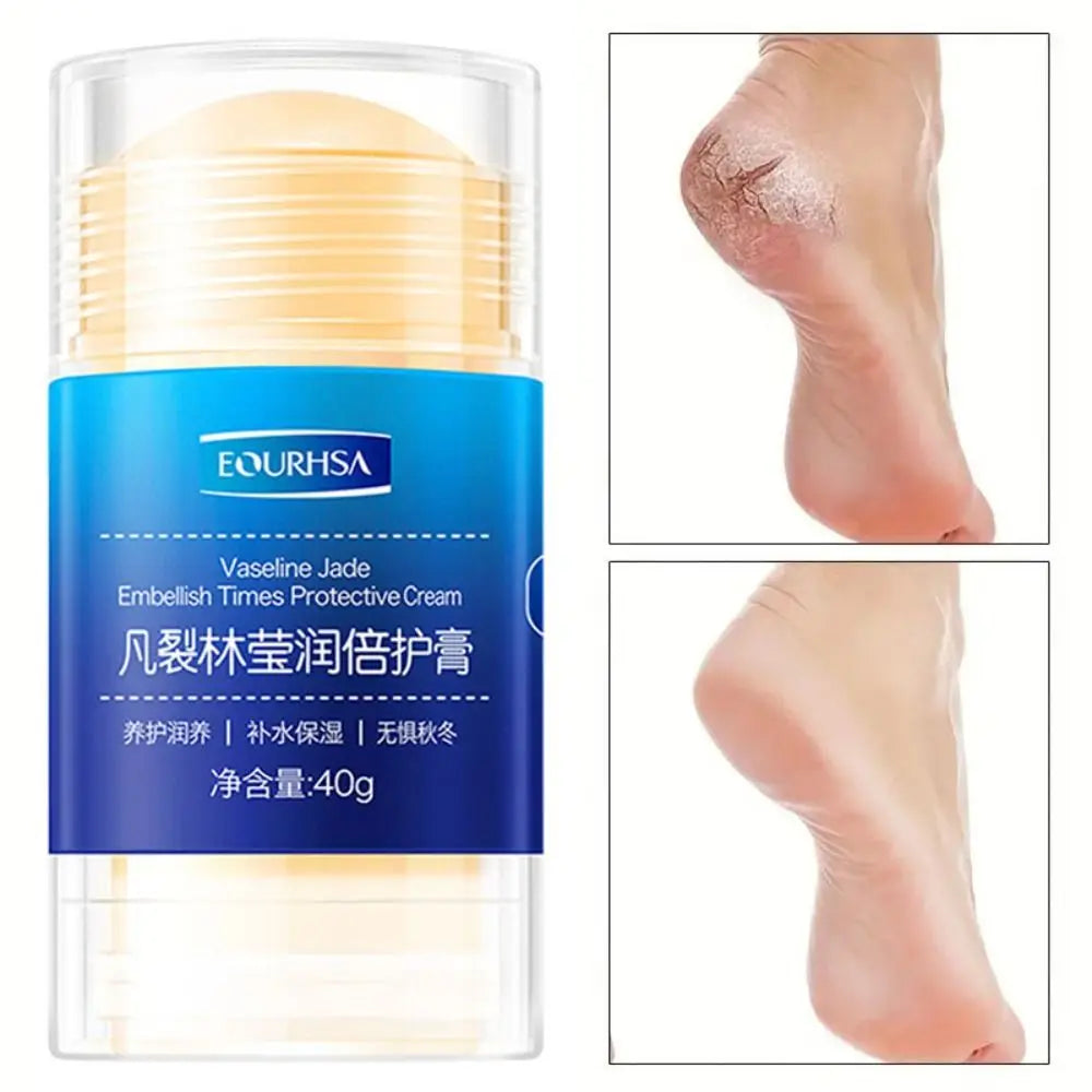 Preventing Cracking Cracked Feet Cream Stick Remobing Dead Skin And Callus Repairing Cracked Feet Dry Rough Skin Cream Stick