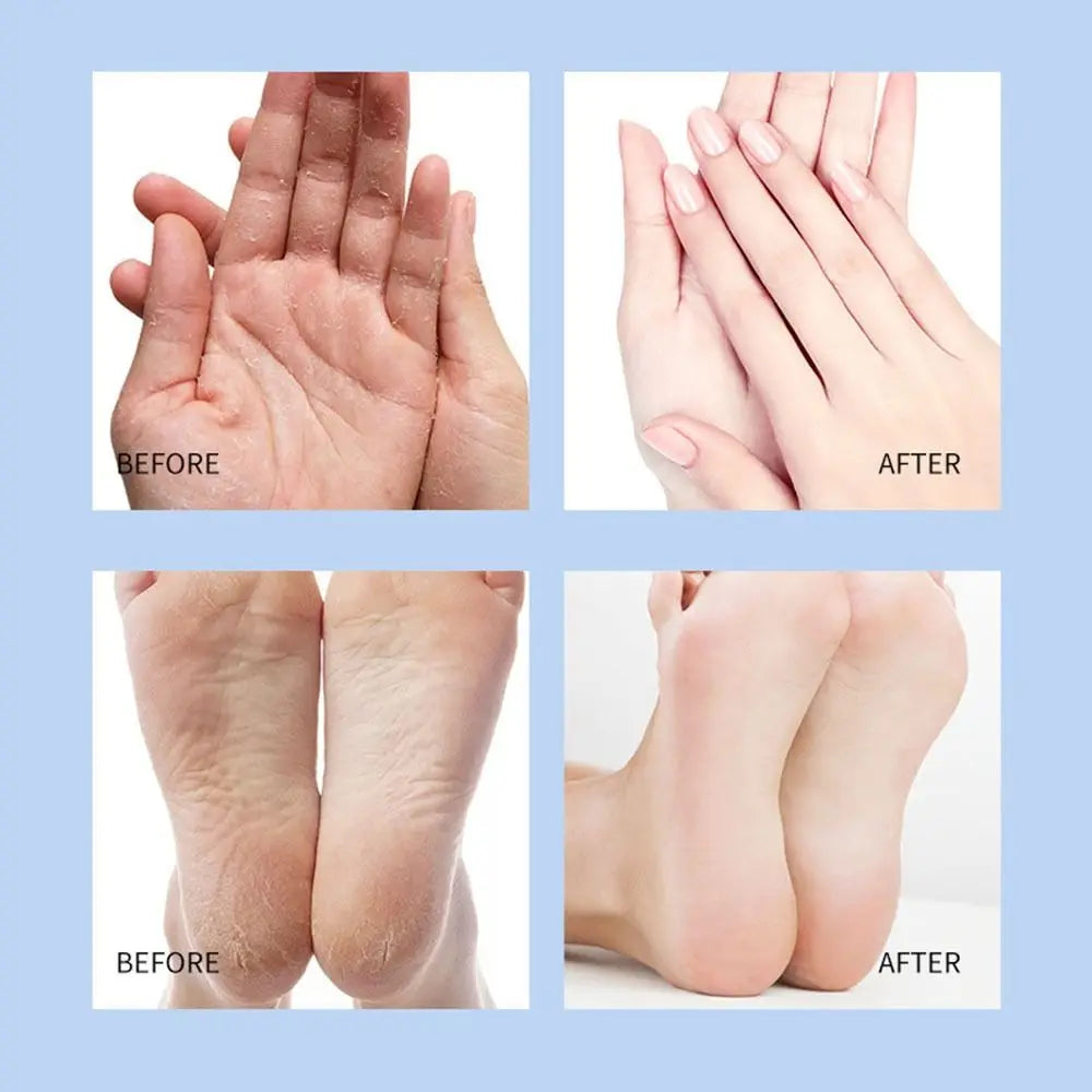 Preventing Cracking Cracked Feet Cream Stick Remobing Dead Skin And Callus Repairing Cracked Feet Dry Rough Skin Cream Stick