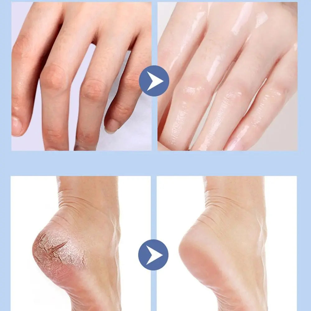 Preventing Cracking Cracked Feet Cream Stick Remobing Dead Skin And Callus Repairing Cracked Feet Dry Rough Skin Cream Stick
