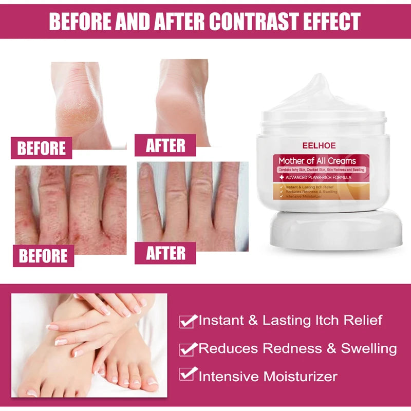 Collagen Cream Body Cream Whitening Hand and Foot Cream Skin Delicate and Smooth Hand and Foot Skin Care Women's Skin Care 30g